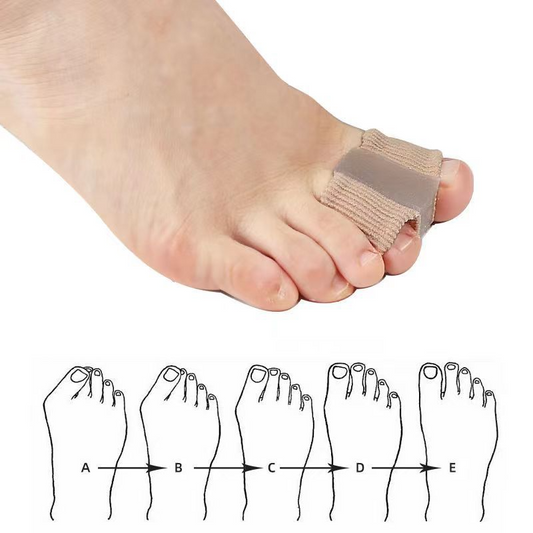 Fiber Toe Separator